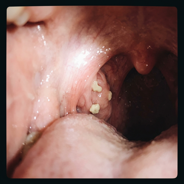 Customer photo before 1