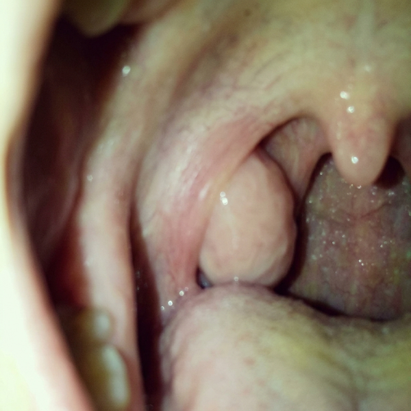 Customer photo after 2