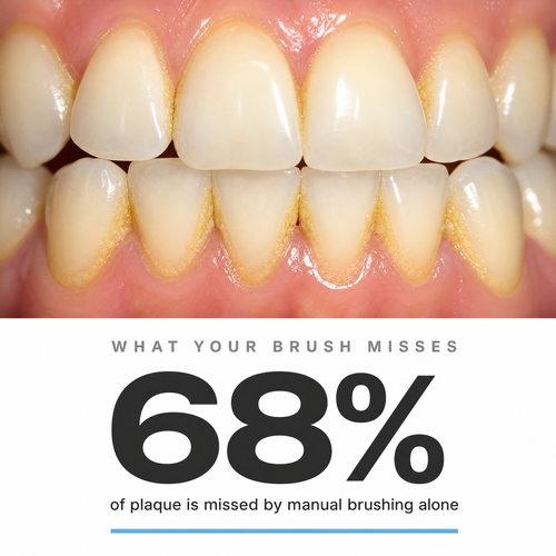 Electric Teeth Cleaner